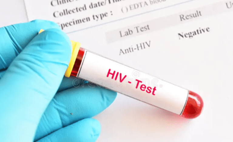 HIV Tests