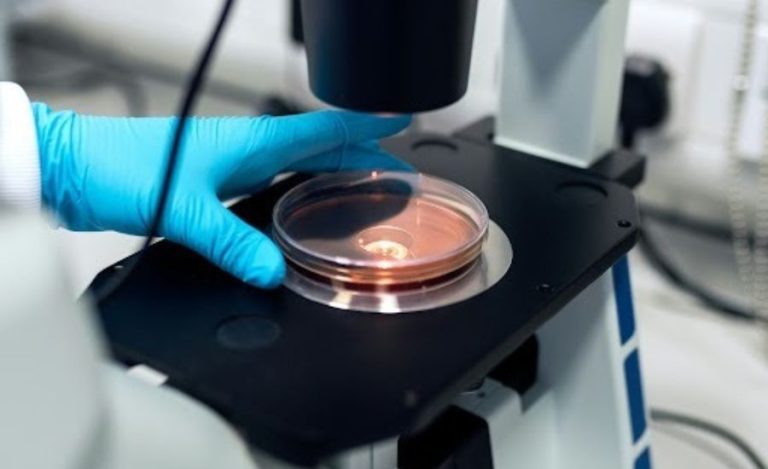 ACE-031 myostatin pathway modulator